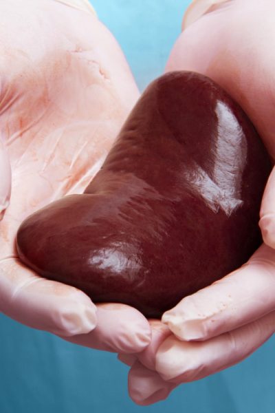 Für die Organspende nie zu alt - Transplantierte Niere