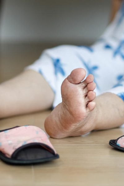 Risiko Oberschenkelhalsbruch - gestürzte Frau am Boden liegend